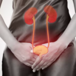 Urinary
