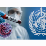 Ebola